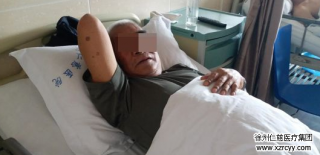 79歲老人患右腹股溝疝10多年，外科李素方主任1.5小時打了3個“小眼”給“補好”了……