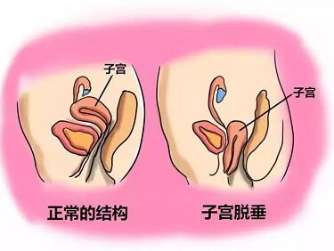 預(yù)約手術(shù)